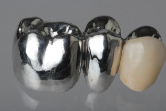 Titanium Crown